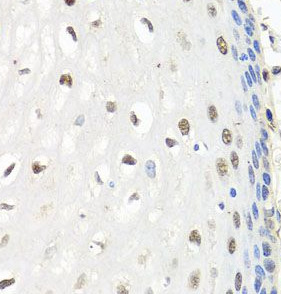 CNOT8 antibody|CNOT8抗体