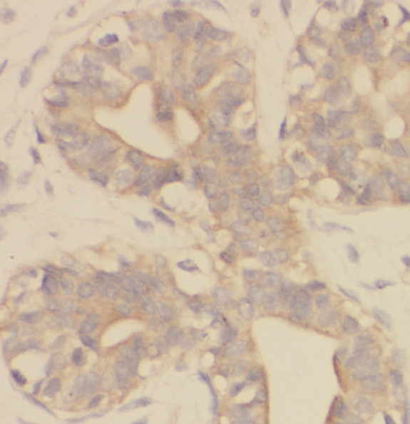 RNF170 antibody|RNF170抗体