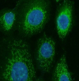 CNDP1 antibody|CNDP1抗体