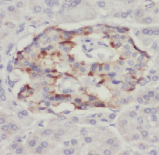 TPST2 antibody|TPST2抗体
