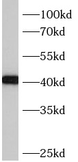 BBS5 antibody|BBS5抗体 FNab00819