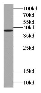 TOMM40 antibody|TOMM40抗体 FNab0