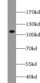 USP38 antibody|USP38抗体