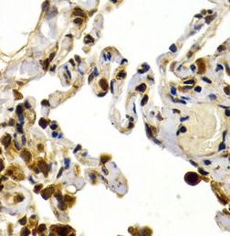 TFDP1 antibody|TFDP1抗体