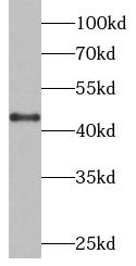 CTSB antibody|CTSB抗体 FNab01304