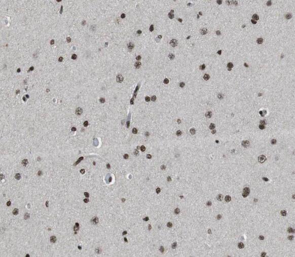 STXBP1 antibody|STXBP1抗体 FNab0