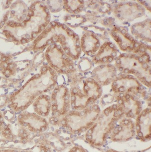 CIB4 antibody|CIB4抗体