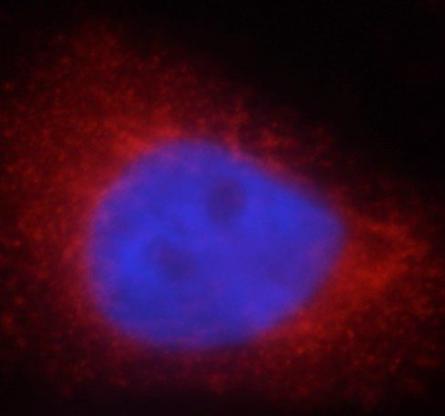 LDHA-Specific antibody|LDHA抗体