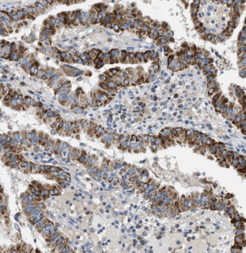 TG antibody|TG抗体 FNab08684