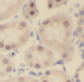NUAK2 antibody|NUAK2抗体