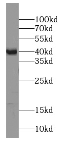 ST8SIA2-Specific antibody|ST8S