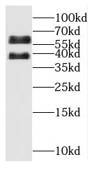 OSGIN1 antibody|OSGIN1抗体