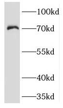 KCNA2 antibody|KCNA2抗体