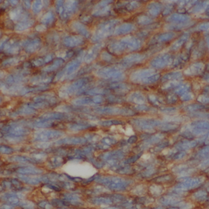 LY6E antibody|LY6E抗体