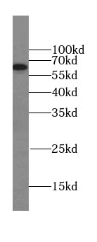 EIF2D antibody|EIF2D抗体