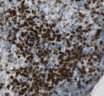 EXOSC10 antibody|EXOSC10抗体 FNa