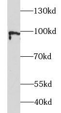 ATF6 antibody|ATF6抗体 FNab00664