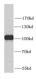 PYGB antibody|PYGB抗体 FNab06973