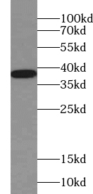 VTA1 antibody|VTA1抗体