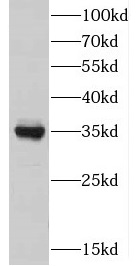 DIMT1 antibody|DIMT1抗体