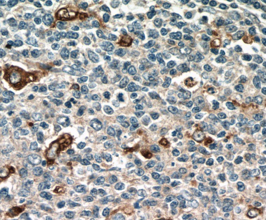 CD68 antibody|CD68抗体 FNab01491