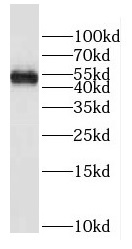DNAAF4 antibody|DNAAF4抗体
