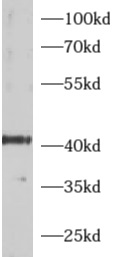 ADRM1 antibody|ADRM1抗体