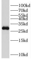 TFPT antibody|TFPT抗体