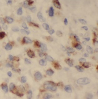 TFF1 antibody|TFF1抗体