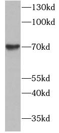PODN antibody|PODN抗体