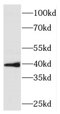 PINX1 antibody|PINX1抗体