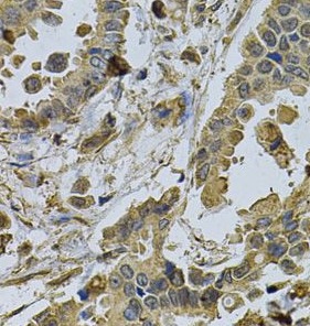 HMGCR antibody|HMGCR抗体 FNab039