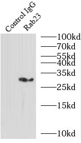 PPFIA3 antibody|PPFIA3抗体