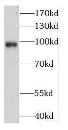 DDX23 antibody|DDX23抗体