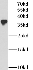 BCL2L14 antibody|BCL2L14抗体