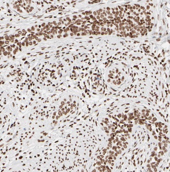 TCF7L1 antibody|TCF7L1抗体