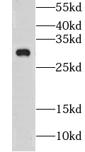 CLDN23 antibody|CLDN23抗体
