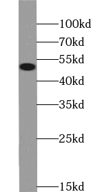 UGT3A2 antibody|UGT3A2抗体