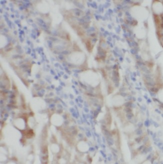 TLR7 antibody|TLR7抗体