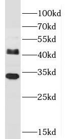 JAM2 antibody|JAM2抗体