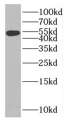 MAGED4 antibody|MAGED4抗体