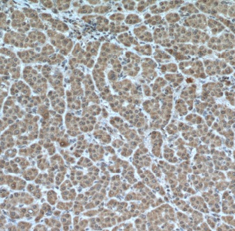 MKS1 antibody|MKS1抗体