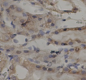 TNFAIP3 antibody|TNFAIP3抗体 FNa