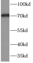 C9 antibody|C9抗体 FNab10107