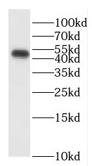 ENPP6 antibody|ENPP6抗体