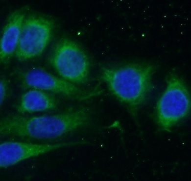 SLN antibody|SLN抗体