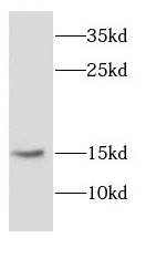 CYB5R3 antibody|CYB5R3抗体 FNab0