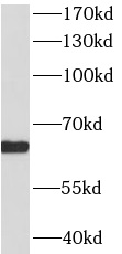 HDAC1 antibody|HDAC1抗体 FNab037