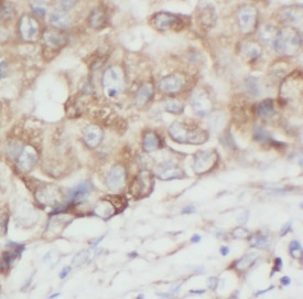 AURKA antibody|AURKA抗体 FNab100