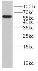 ENTPD3 antibody|ENTPD3抗体